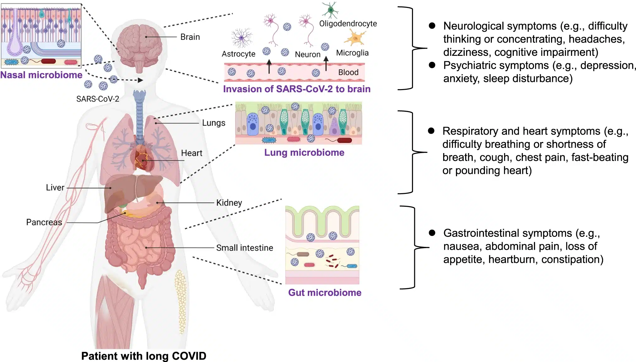 the gut–brain axis