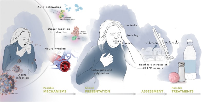 Covid Symptoms